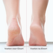 Elvori Smooth 3