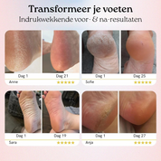 Eenmalige aanbieding: Geef de Elvori™ Eeltverwijderaar als cadeau! 🎁